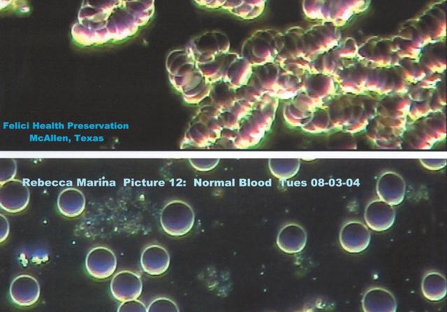 Blood cells 